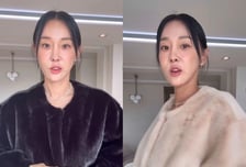 이지혜, 인중 축소술 받고 달라진 외모…"앞니 자동 플러팅"
