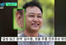 "김수용 귓불, 나랑 똑같아" 심근경색 걱정했는데...전문가 의견은?