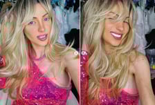 '인간 바비' 되겠다며 30번 성형한 여성, 속옷 차림으로 '의문사'