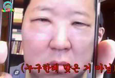 정형돈, 퉁퉁 부은 눈 공개 "일주일 동안 못 나가"…무슨 일?