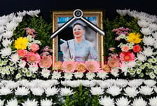 故김지미 앓던 '이 병', 바늘 찌르는 고통…"안면마비·우울증도 부른다"