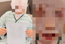 "떠날까봐 못생기게 만들려고"…태국인 아내 얼굴에 끓는 물 부은 40대