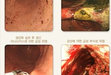 "그냥 숙취인 줄 알았는데"...당장 병원 가야 할 복통 신호