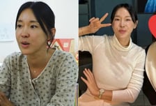 "이제 입 닫힌다" 이지혜, 인중축소술 1달...달라진 얼굴 공개
