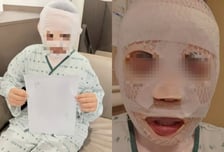 "예쁜 아내 떠날까 봐"...'못생기게 만들려고' 끓는 물 부은 남편