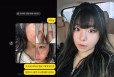 재키와이, 전 남친에 '감금·폭행' 피해…AOMG "법적 절차 밟는 중"