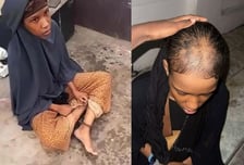 족쇄 차고 삭발까지…소말리아 수용소에 갇혀지난 영국 소녀, 무슨일?