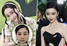 17억 들여 판빙빙처럼 성형, 의사 남편도 생겼는데..."나 돌아갈래"