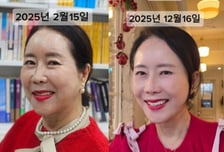 "63세 맞아?" 20살 어려진 윤영미..."한 달 전 센 시술, 만족" 뭐길래