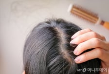 李대통령 "탈모약 건보 적용 검토" 한마디에 탈모株 쑥쑥