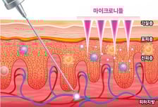 라파스, '붙이는 알레르기 비염약' 임상 1상 성공
