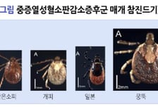 [더벨]진원생명과학, 'GLS-5140' 임상 재도전