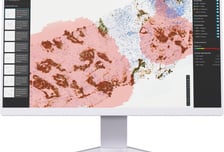 루닛, HER2 진단서 의사-AI 판독 일치도 83.5%…의사 간 편차보다 낮아