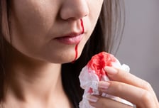 눈물·코피 날 때 '이것' 당장 마셔야…겨울 탈수가 해치는 '뜻밖의 부위'