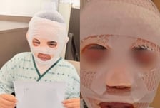 아내 얼굴에 끓는 물 부은 남편, 구속 송치…"실수" 끝내 혐의 부인