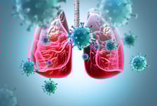 기침도 열도 없는데 폐결핵…'무증상' 3명 중 1명에 달해