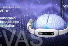 아리바이오, 치매 전자약 'GVD-01' 신의료 기술평가 서비스 대상 기술 선정