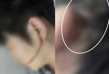 '안산 물 축제' 워터건 부상 사고, 용역업체·재단 직원 무더기 송치