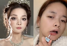 20초에 560만원 번다? 빚 청산한 뇌성마비 여성..."가짜 장애냐" 의혹도