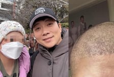 "3번째 암 수술+삭발"…김재욱, '육종암 투병' 여동생 응원