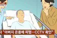 아버지 온 몸에 피멍이…요양원 입원 두 달 만에 사망, CCTV 봤더니