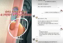 "18만원 케이스, 불량인데 고객 탓…소보원 신고하니 뒤늦게 교환"