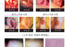 로킷헬스케어, 'AI 연골 재생 플랫폼' 남미 진출…해외 확장 시동