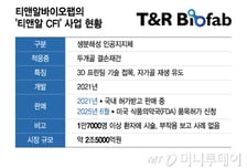 티앤알바이오팹, 두개골임플란트 美허가절차 순항…"2.5조 시장 공략"