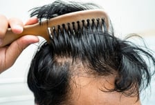 "머리가 점점" 그 말에 빠진 남자, 손에 들린 건...'탈모' 회사 차린 이유[월드콘]