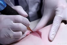 식약처 "문신용 염료 엄격 관리…사용금지 72종·함량제한 10종 지정"