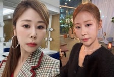 "코에 갈비뼈 잘라 넣었다" '서준맘' 박세미, 재성형 미모 눈길