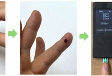 "손끝 채혈로 칼륨 측정" 말기콩팥병 환자 심정지 막을 길 열렸다