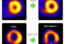 "소화불량 아니었다" 돌연사 부르는 '이 질환'...강추위에 비상