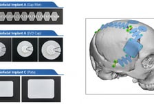 티앤알바이오팹, CB 상환부담 해소…"유동성 문제 해결, 올해 도약"