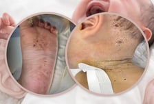 온몸에 바늘 자국 600개...생후 10개월 아기 찌른 엄마, 중국 '발칵'