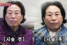 '하이닉스 평단 2만원' 짠순이 전원주, 500만원 피부 시술 '깜짝'