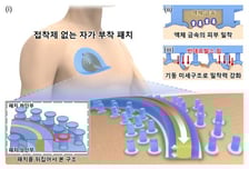 젤·접착제 없이 붙는 심전도 패치 개발…500회 재사용 가능