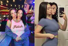 비키니 입고 유명해진 '샴쌍둥이'…"역겨워" 뭇매 쏟아진 이유는