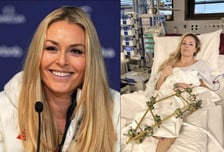 '美스키 여제' 린지 본, 올림픽 부상 뒤 세 번째 수술..."성공의 의미 달라져"