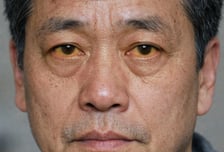 "술 안 마셔도 생겼다" 초기 증상 없는 '침묵의 암' 간암 원인은?