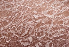 "자면서 하얀가루 뚝뚝" 박박 긁게 된 피부...샤워 방법이 문제였다?