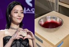 차주영, 대접 가득 채운 출혈량…"1시간 넘게" 비출혈 증상 뭐길래