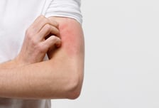 "너무 간지러워" 성관계 후 벅벅…수건도 위험한 '이 병' 미국 비상