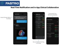 美 뇌졸중 가이드라인 발표에…제이엘케이, 글로벌 시장 선점 '기대감'