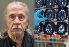 "치매 아내 돌볼 바엔 감옥 갈래" 맨정신에 총 쏜 80대 전직 경찰