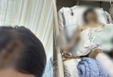 씩 웃더니 멍키스패너로 폭행..."출소해도 50살" 생존자 떤다[뉴스속오늘]