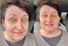 안과 진료 중 '형광 녹색'으로 변한 눈동자…갑자기 무슨 일