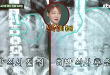 10인분 식사 전후 '위 크기 사진' 공개한 히밥…"신축성 너무 좋아"