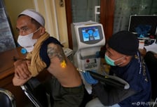 "문신하고 시력 잃었다"…'타투 인구' 늘자 포도막염 경고[1분 생활백서]