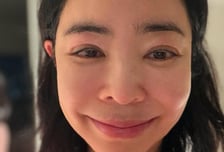 '폐암 수술' 이혜영, 후유증에 눈 퉁퉁..."건강 회복이 목표"